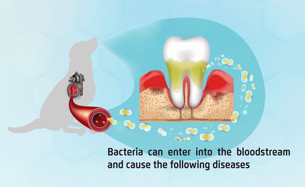 Bacteria from inflamed gums can enter the bloodstream and cause lots of diseases, like tumors, diabetes, liver and kidney diseases and so on